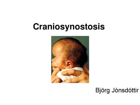 Craniosynostosis Björg Jónsdóttir