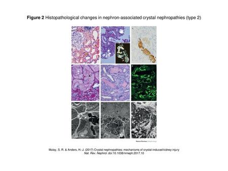 Nat. Rev. Nephrol. doi: /nrneph