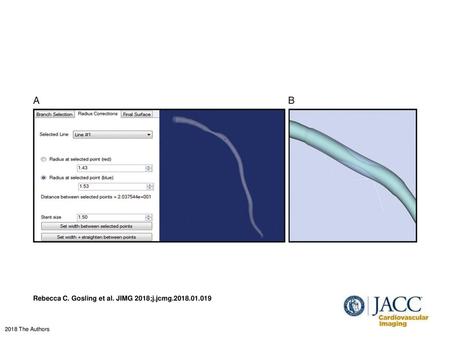 Rebecca C. Gosling et al. JIMG 2018;j.jcmg