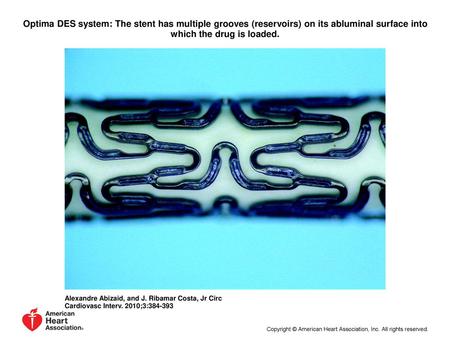 Optima DES system: The stent has multiple grooves (reservoirs) on its abluminal surface into which the drug is loaded. Optima DES system: The stent has.