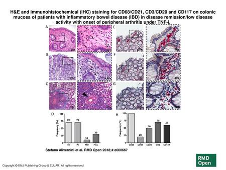 H&E and immunohistochemical (IHC) staining for CD68/CD21, CD3/CD20 and CD117 on colonic mucosa of patients with inflammatory bowel disease (IBD) in disease.