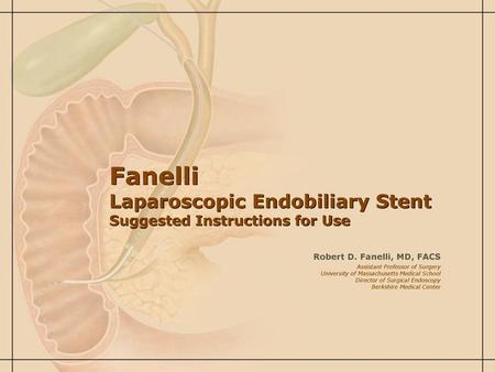 Fanelli Laparoscopic Endobiliary Stent Suggested Instructions for Use