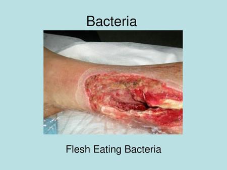 Bacteria Flesh Eating Bacteria.