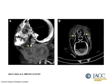 Adel H. Allam et al. JIMG 2011;4: