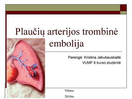 Plaučių arterijos trombinė embolija