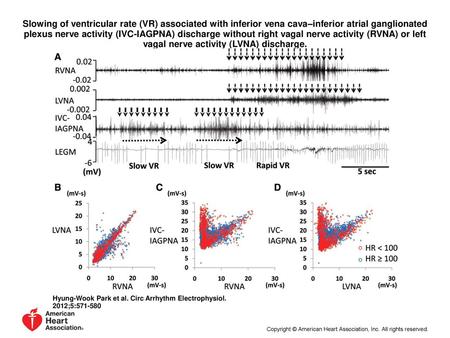 Slowing of ventricular rate (VR) associated with inferior vena cava–inferior atrial ganglionated plexus nerve activity (IVC-IAGPNA) discharge without right.