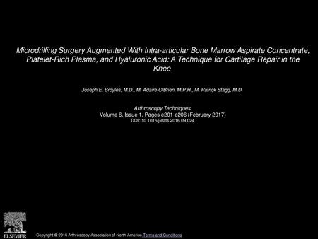 Microdrilling Surgery Augmented With Intra-articular Bone Marrow Aspirate Concentrate, Platelet-Rich Plasma, and Hyaluronic Acid: A Technique for Cartilage.