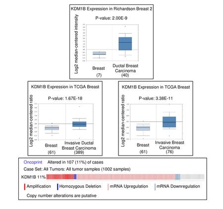 KDM1B Expression in Richardson Breast 2