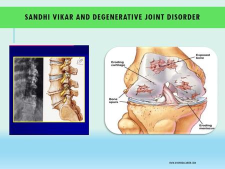 Sandhi Vikar and DEGENERATIVE JOINT DISORDER