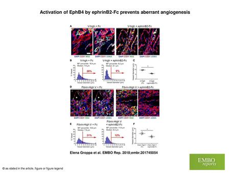 Activation of EphB4 by ephrinB2‐Fc prevents aberrant angiogenesis