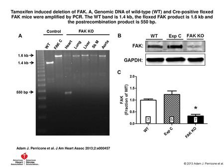 Tamoxifen induced deletion of FAK