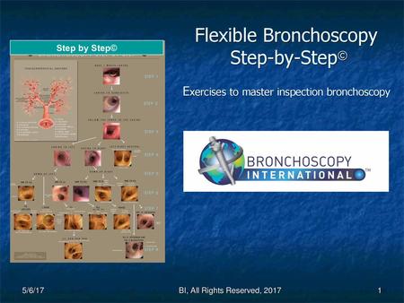 Flexible Bronchoscopy Step-by-Step© Exercises to master inspection bronchoscopy 5/6/17 BI, All Rights Reserved, 2017.