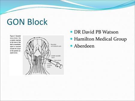 GON Block DR David PB Watson Hamilton Medical Group Aberdeen.