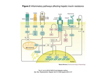 Figure 2 Inflammatory pathways affecting hepatic insulin resistance