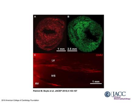 Patrick M. Boyle et al. JACEP 2018;4: