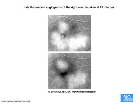 Late fluorescein angiograms of the right macula taken at 13 minutes.