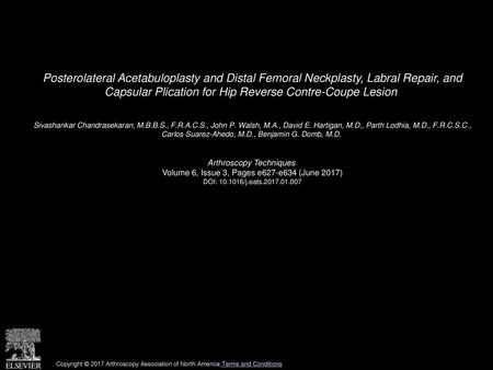 Posterolateral Acetabuloplasty and Distal Femoral Neckplasty, Labral Repair, and Capsular Plication for Hip Reverse Contre-Coupe Lesion  Sivashankar Chandrasekaran,