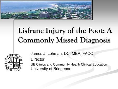 Lisfranc Injury of the Foot: A Commonly Missed Diagnosis