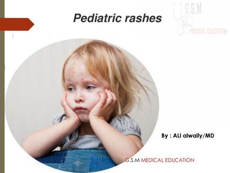 Pediatric rashes By : ALI alwaily/MD G.S.M MEDICAL EDUCATION.