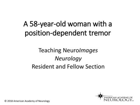 A 58-year-old woman with a position-dependent tremor