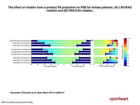 The effect of rotation from a primary PA projection on PSD for female patients: (A) LAO/RAO rotation and (B) CRA/CAU rotation. The effect of rotation from.