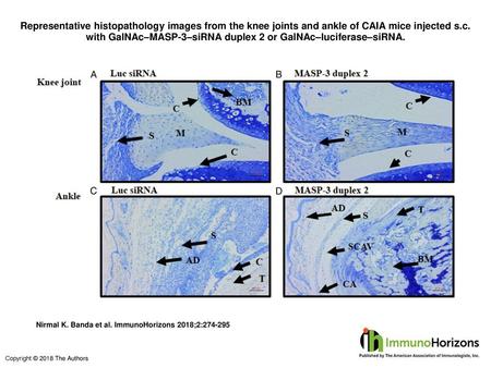 Representative histopathology images from the knee joints and ankle of CAIA mice injected s.c. with GalNAc–MASP-3–siRNA duplex 2 or GalNAc–luciferase–siRNA.