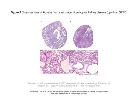 Nat. Rev. Nephrol. doi: /nrneph