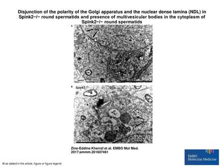 Disjunction of the polarity of the Golgi apparatus and the nuclear dense lamina (NDL) in Spink2−/− round spermatids and presence of multivesicular bodies.