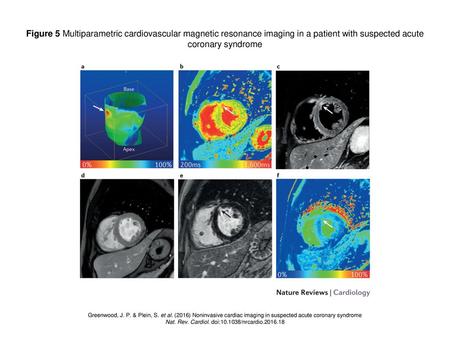 Nat. Rev. Cardiol. doi: /nrcardio