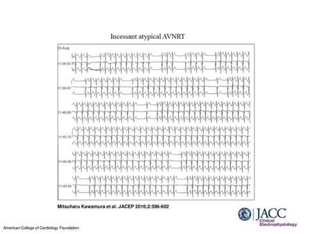 Mitsuharu Kawamura et al. JACEP 2016;2: