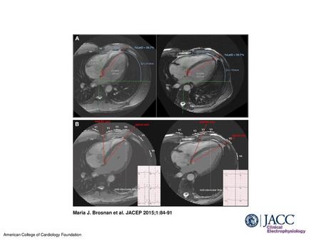 Maria J. Brosnan et al. JACEP 2015;1:84-91