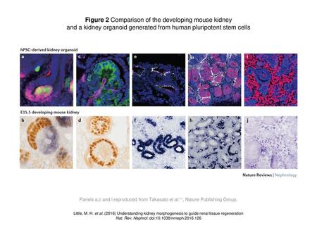 Figure 2 Comparison of the developing mouse kidney