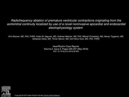 Radiofrequency ablation of premature ventricular contractions originating from the aortomitral continuity localized by use of a novel noninvasive epicardial.