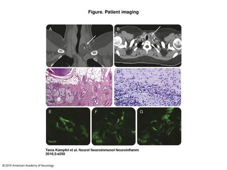 Figure. Patient imaging