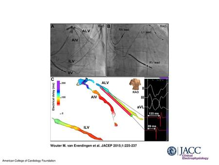 Wouter M. van Everdingen et al. JACEP 2015;1: