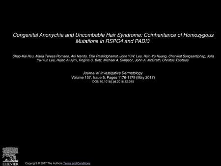 Congenital Anonychia and Uncombable Hair Syndrome: Coinheritance of Homozygous Mutations in RSPO4 and PADI3  Chao-Kai Hsu, Maria Teresa Romano, Arti Nanda,