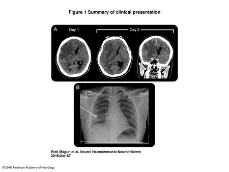 Figure 1 Summary of clinical presentation