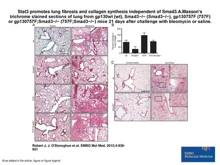 Stat3 promotes lung fibrosis and collagen synthesis independent of Smad3.A.Masson's trichrome stained sections of lung from gp130wt (wt), Smad3−/− (Smad3−/−),