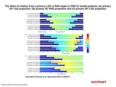 The effect of rotation from a primary LAO or RAO angle on PSD for female patients: (A) primary 30° LAO projection; (B) primary 30° RAO projection and (C)