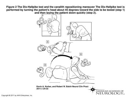 Figure 2 The Dix-Hallpike test and the canalith repositioning maneuver The Dix-Hallpike test is performed by turning the patient's head about 45 degrees.