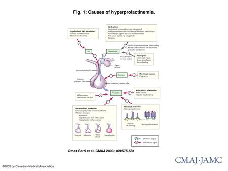 Fig. 1: Causes of hyperprolactinemia.