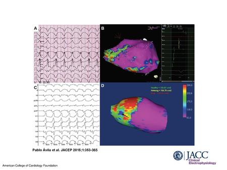 Pablo Ávila et al. JACEP 2015;1: