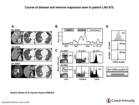 Course of disease and immune responses seen in patient LAU 672.