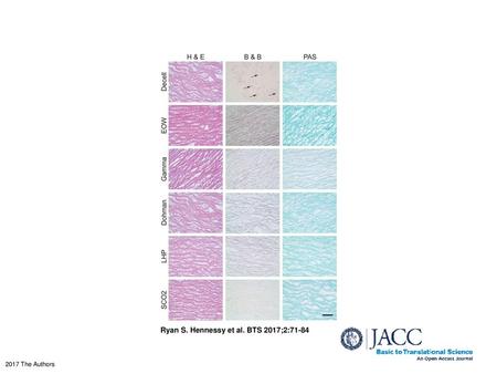 Ryan S. Hennessy et al. BTS 2017;2:71-84
