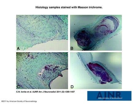 Histology samples stained with Masson trichrome.