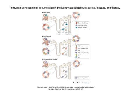 Nat. Rev. Nephrol. doi: /nrneph