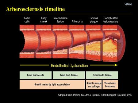 Section 4: Plaque dynamics and stenosis