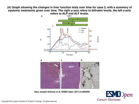 (A) Graph showing the changes in liver function tests over time for case 3, with a summary of systemic treatments given over time. The right y-axis refers.