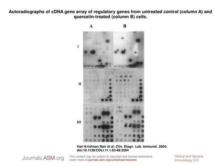 Autoradiographs of cDNA gene array of regulatory genes from untreated control (column A) and quercetin-treated (column B) cells. Autoradiographs of cDNA.