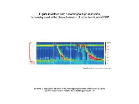 Figure 2 Metrics from oesophageal high-resolution